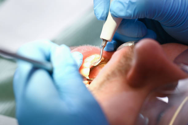 Best Emergency Dental Care for Trauma or Injury in Union City, IN
